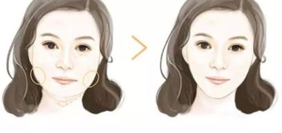 石家莊雙眼皮二次修復首選！排行榜公布最佳八強名單