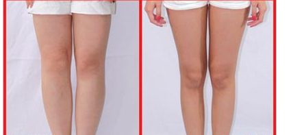 昆山人民醫(yī)院美容科提供哪些整形項(xiàng)目？著名醫(yī)師坐診+讓您雙眼煥發(fā)迷人魅力！