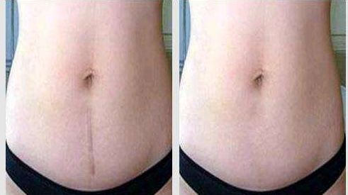 深圳很受推崇的雙眼皮修復(fù)醫(yī)生榜單發(fā)布！探尋盡善盡美之道