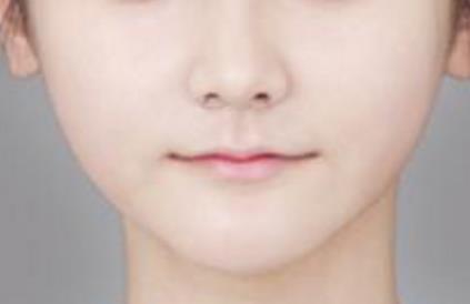 呼和浩特鼻部整形有哪些醫(yī)院可以信賴？為您推薦理想選擇