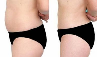 沈陽醫(yī)大一院醫(yī)美，尋覓技術(shù)高超的大夫，暢談假體隆鼻案例！