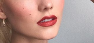 北京八大處整形外科醫(yī)生趙延勇的項(xiàng)目特長及真實(shí)去眼袋案例分享