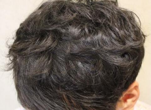 沈陽(yáng)整形醫(yī)院哪家技術(shù)更先進(jìn)？有哪些正規(guī)醫(yī)美機(jī)構(gòu)？（附詳細(xì)價(jià)目表）