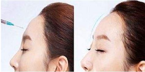 昆明市五星整形醫(yī)院排行榜top5，哪家效果好？醫(yī)美人士最愛！