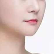 重磅推薦！全國(guó)頂級(jí)雙眼皮修復(fù)專家榜單揭曉，這四位醫(yī)師備受贊譽(yù)