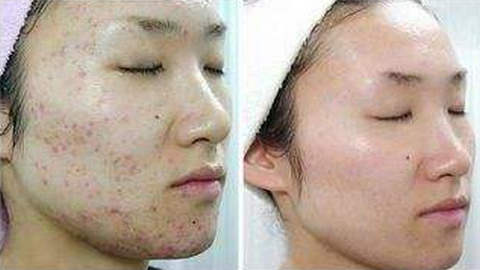 蘇州人民醫(yī)院整形科割眼袋靠譜嗎？專家資料簡介，網(wǎng)友評價如何？