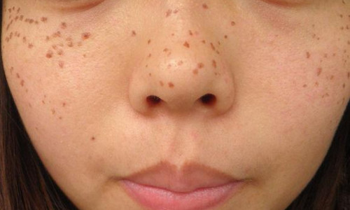 南京伊爾美醫(yī)療美容醫(yī)院真的可信嗎？有人分享他們的新醫(yī)院信息嗎？