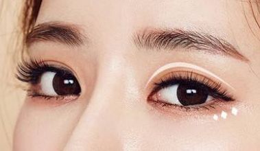 名師團(tuán)隊(duì)加持，葉飛輪打造雙眼皮，成就有形雙眼美！