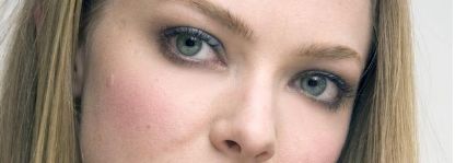 王醫(yī)生揭秘！湘雅附二實(shí)操雙眼皮術(shù)后成效公開！