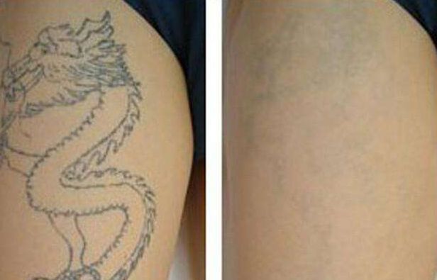 北京割雙眼皮哪家醫(yī)院口碑比較好？排名前三的醫(yī)院推薦！