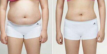 恩施奧萊做大拉皮有哪些效果？你知道嗎？