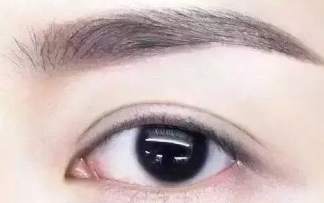 全國哪位專家值得信賴修復(fù)雙眼皮手術(shù)？頂級醫(yī)生排行榜首推名單揭曉