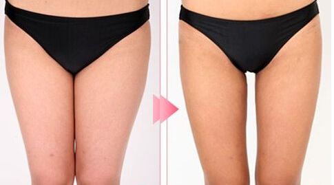 哈爾濱市十大雙眼皮整形醫(yī)生，絕對可信賴！