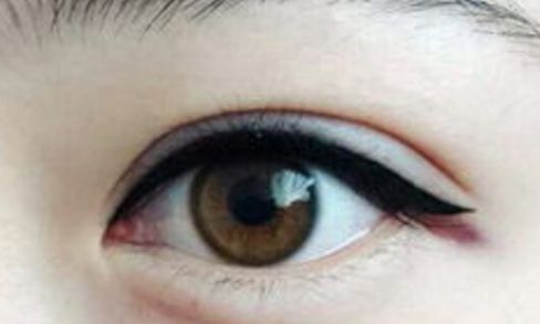 南京隆鼻術中高手脫穎而出！三位醫(yī)生實力強勁！