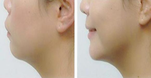 南京五家美容醫(yī)院，優(yōu)秀的整形實(shí)力與醫(yī)療專家分析