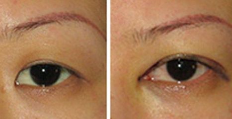 2023年北京專業(yè)處拉皮手術醫(yī)生推薦