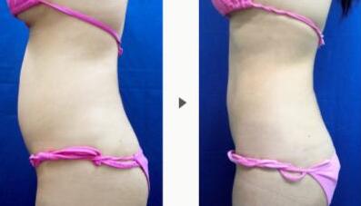 上海華美醫(yī)療美容整形醫(yī)院技術(shù)真的靠譜嗎？那里的醫(yī)生有經(jīng)驗嗎？