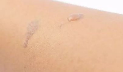 整形醫(yī)生楊小順在鄭州陽光創(chuàng)美進行眼部手術(shù)口碑如何？