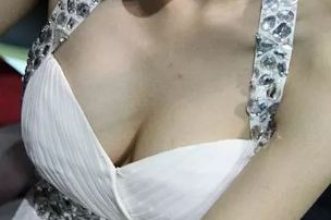 深圳陽光醫(yī)療美容醫(yī)院玻尿酸面部填充2023案例分享