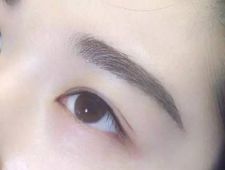 李炳澮醫(yī)生獨特的技術 手術風格有何特點？并附帶隆鼻案例分析