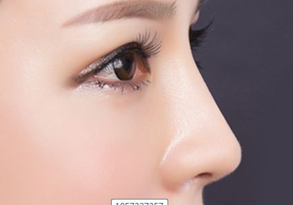 李天石磨骨費用公示與患者見證，現(xiàn)網友分享醫(yī)師簡介！