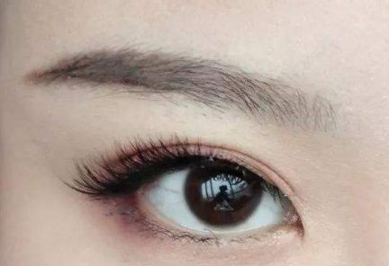 大連王琳雙眼皮的完美實(shí)踐，80天親身體驗(yàn)揭秘