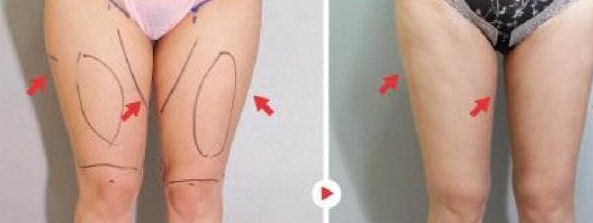 國內(nèi)頂級隆胸醫(yī)生名人榜，權(quán)威大咖云集