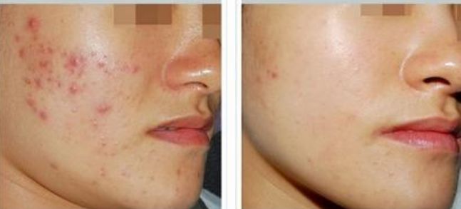 精準(zhǔn)又放心！臉部開眼角手術(shù)推薦哪座醫(yī)院好？