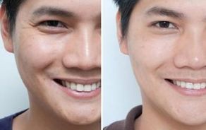 深圳整形醫(yī)院盛名鼎革，不容錯(cuò)過(guò)！