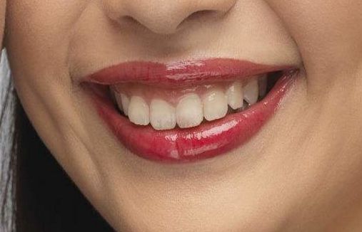 2023年北京近視手術(shù)高手引領(lǐng)潮流，瞿長(zhǎng)斌、林順潮、熊瑛等五位專(zhuān)家資料公開(kāi)！