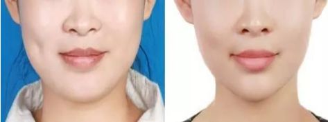 武漢市優(yōu)質近視手術醫(yī)院排名榜單精選！信賴度極高的醫(yī)療機構！