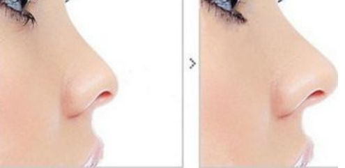 2023年，揭示重慶整形醫(yī)院的實(shí)力和口碑的全新文章！