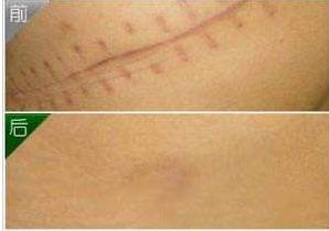 杭州面部脂肪填充推薦，首選頂級醫(yī)生信息大揭密