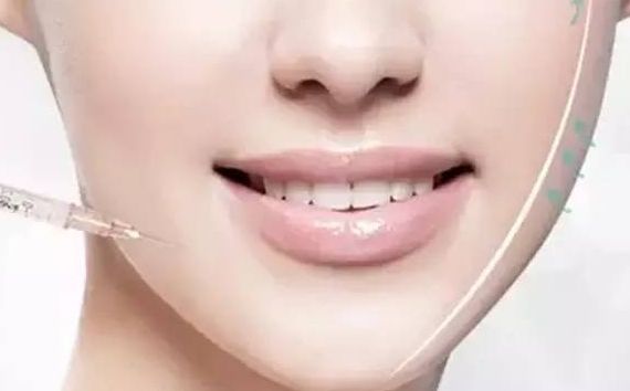 上海九院王健的雙眼皮手術(shù)效果如何？醫(yī)生經(jīng)驗與成功案例分享