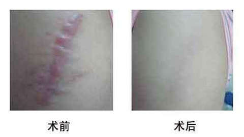 濟(jì)南有哪些人氣更高的美容整形醫(yī)院海峽和旭美如何評價