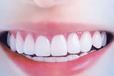 武漢伊萊美美容整形醫(yī)院資質(zhì)如何？口碑怎么樣？有哪些擅長的項目推薦呢？為你揭秘！伊萊美醫(yī)院值得信賴嗎？