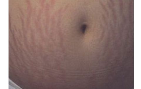 南昌佳美整形醫(yī)院：醫(yī)生團(tuán)隊(duì)強(qiáng)大，雙眼皮案例獨(dú)具匠心