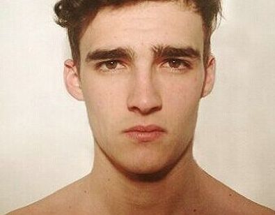 湘雅醫(yī)院龍劍虹的口碑如何？醫(yī)術(shù)出眾，附真實(shí)雙眼皮術(shù)后恢復(fù)圖！