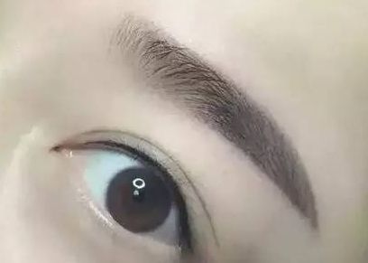 醫(yī)生楊明勇：從技術(shù)實(shí)力到用戶評(píng)價(jià)揭秘，提眉案例評(píng)價(jià)出乎預(yù)料！