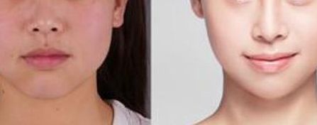 北京最具實(shí)力的植發(fā)醫(yī)院推薦，讓您了解八大處整形醫(yī)院植發(fā)費(fèi)用與醫(yī)生水平