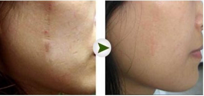 2023昆明地區(qū)頂級(jí)鼻部整形醫(yī)院排行榜揭曉！悉數(shù)解析各院隆鼻技術(shù)獨(dú)到之處