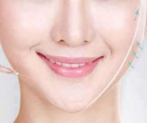 大坪醫(yī)院金絲骨針術(shù)醫(yī)師值得推薦，服務(wù)價格一覽無余！