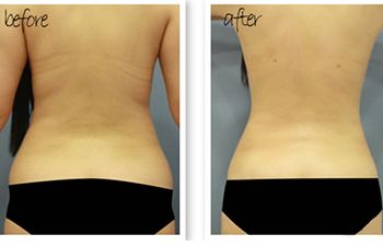 北京哪位醫(yī)生在八大處進(jìn)行隆胸手術(shù)較為專業(yè)？