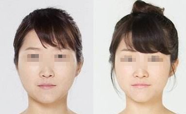 廣州哪家醫(yī)院能夠有效除皺？詳細(xì)介紹醫(yī)院基本情況分享