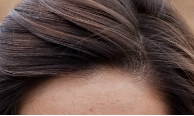 陽泉煤業(yè)集團總醫(yī)院整形美容科2023價格表：優(yōu)惠價格真實可信嗎？醫(yī)師團隊經(jīng)驗豐富？