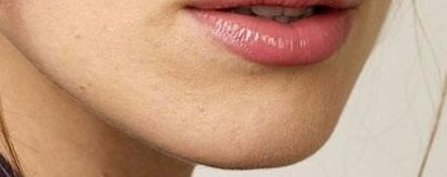 2023年北京大腿脂肪醫(yī)院排名對比，醫(yī)療技術(shù)強勁競爭