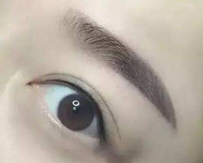 廈門哪家整形醫(yī)院口碑好？專家推薦薇格、中山前三！