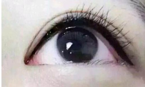 上海千美醫(yī)療美容院五位醫(yī)生實(shí)力對(duì)比！