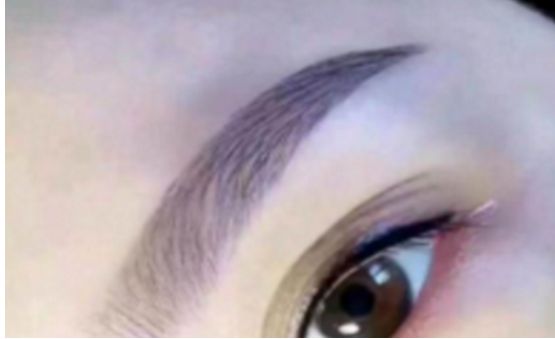 上海求美醫(yī)院最權(quán)威的拉皮整形專家名單及案例分享，查看收費(fèi)明細(xì)表