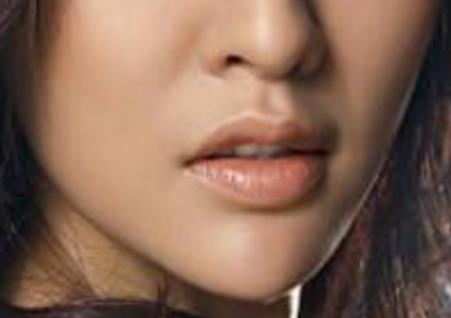 滄州中心醫(yī)院整形科馬超雙眼皮修復(fù)有哪些效果？是否可持久保持雙眼皮效果？